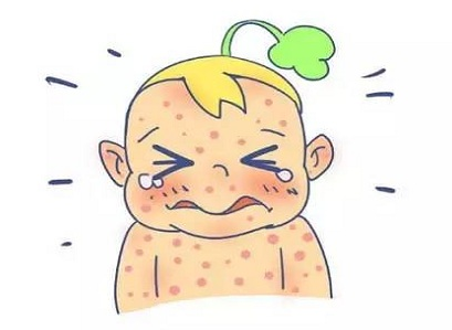 艾蓓尔洗润双星：儿童湿疹沐浴油，让妈妈更放心！